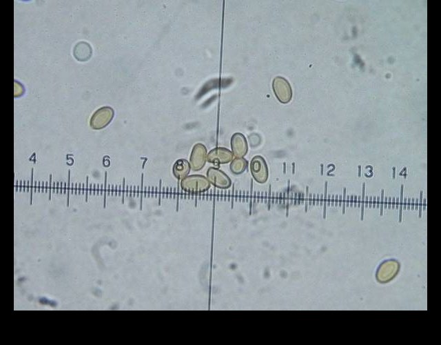 Le Conocybe printanier : spores &copy;photo O. Lussiana