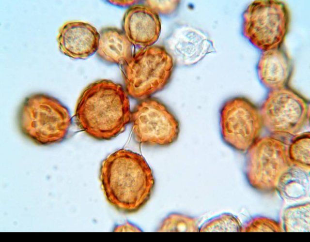 Téleutospores de Uromyces scutellatus &copy;Photo Ph. Pellicier