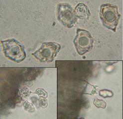 Entoloma hirtipes <p>Entoloma hirtipes, mircoscopie : en bas basides X 400 et en haut spores X 1000</p>