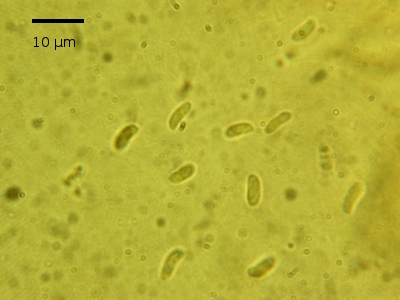 Spores dans le melzer