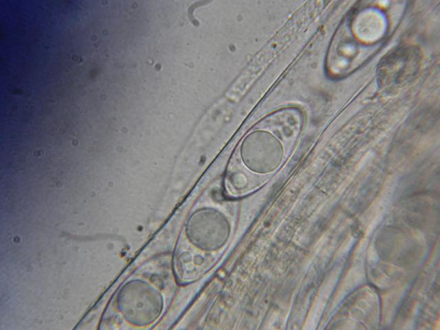 <p>Gyromitra accumbens, spores dans les asques X 1000</p>